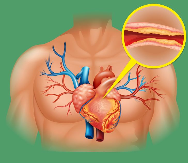 7 điều xảy ra với cơ thể nếu bạn ăn củ hành tây thường xuyên 