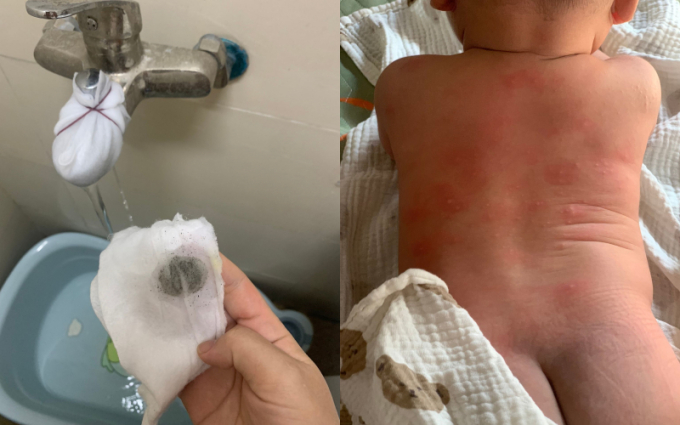 Nước có cặn đen bẩn, trẻ em nổi mẩn ngứa sau khi sử dụng nước được cung cấp.