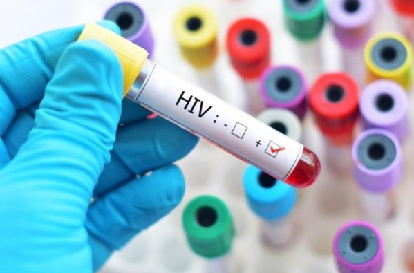 Con đường mới lây nhiễm HIV báo động trong giới trẻ Việt