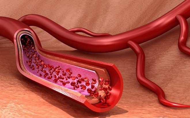 Ăn quá nhiều muối có thể gây tăng huyết áp, tăng cholesterol trong máu, làm cho mạch máu mỏng và giòn.