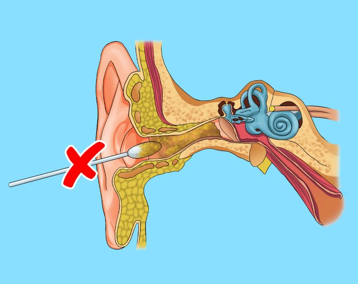 Làm thế nào để vệ sinh tai đúng cách? - Ảnh 11.