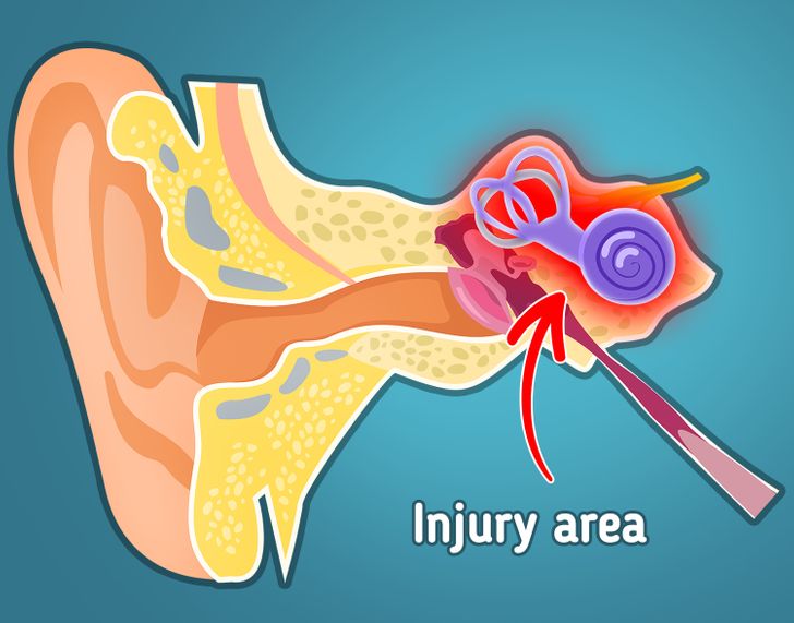 Tại sao bạn thường nghe thấy âm thanh lạ trong tai và cách khắc phục?