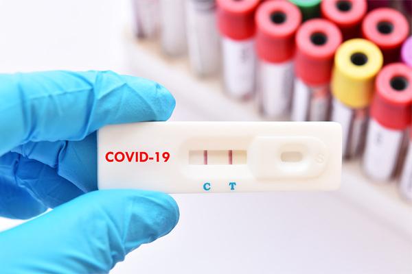 Cảnh báo mức độ nghiêm trọng hơn hoặc có thể truyền nhiễm nhanh hơn của 2 dòng virus biến thể Omicron