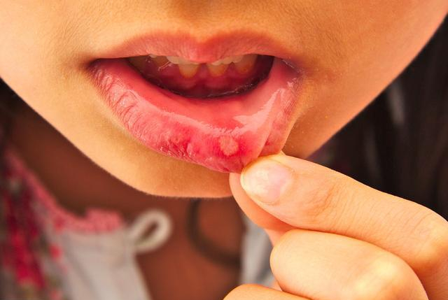 6 dấu hiệu cảnh báo trước khi ung thư ập đến, ít ai chú ý tới