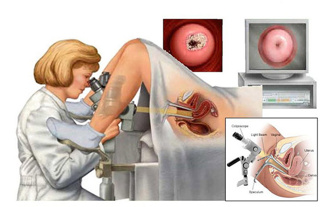 Chích ngừa, tầm soát ung thư là cách ngăn ngừa ung thư hiệu quả. 