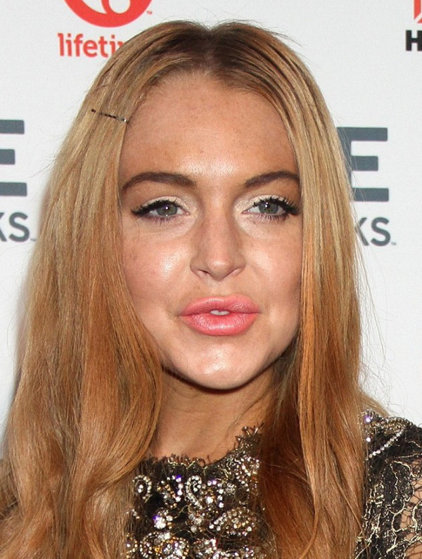 Lindsay Lohan sau 4 lần phẫu thuật thẩm mỹ 