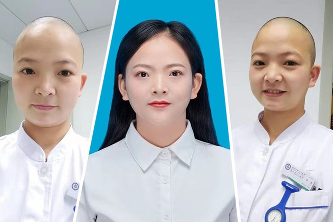 Shan Xia, y tá tại Bệnh viện Renmin, Đại học Vũ Hán, đã cạo trọc đầu để phòng lây nhiễm chéo virus corona.