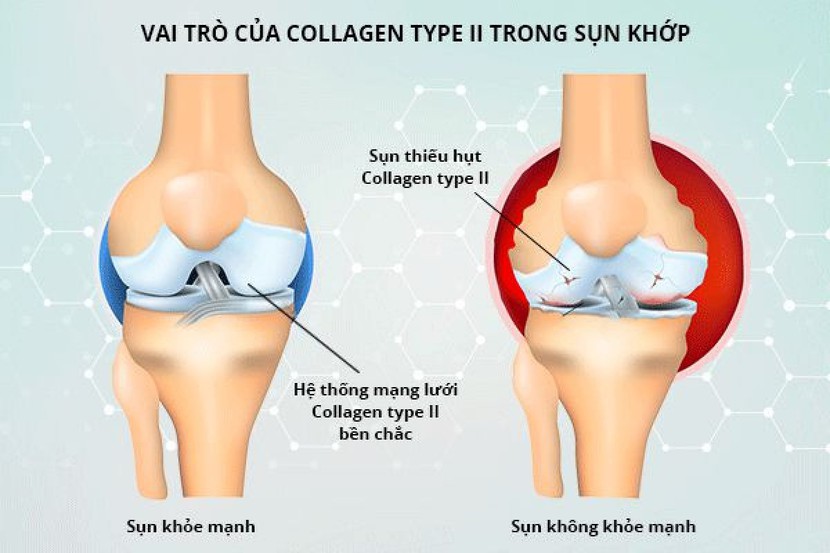 Tác dụng tuyệt vời của collagen đối với cơ thể - Ảnh 4.