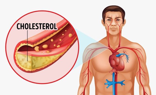 10 lợi ích của chuối mà bạn có thể chưa biết - Ảnh 5.