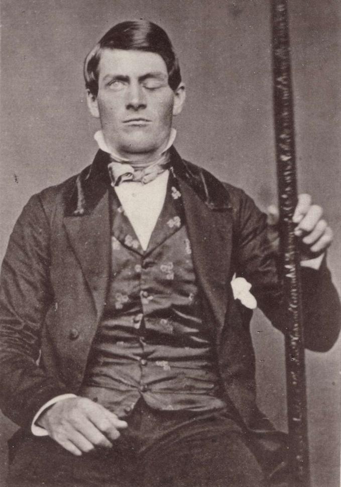 Phineas Gage