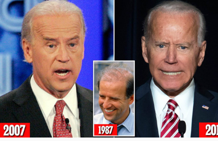   Ông Joe Biden cũng làm răng để được trắng đều.  