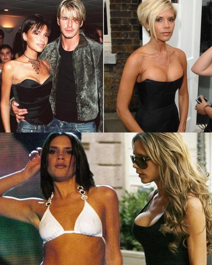 Từng có thời, Victoria Beckham trùng tu vòng 1 quá đà đến mức tổng thể thân hình nhìn quá thiếu tự nhiên, dẫn đến tranh cãi khắp MXH