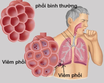 Than tổ ong là hiểm họa tiềm ẩn gây ra nhiều tác hại lên sức khỏe và môi trường.