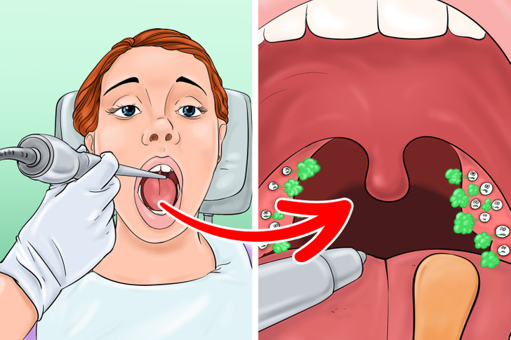 5 mẹo đơn giản để có được hơi thở thơm tho - Ảnh 1.